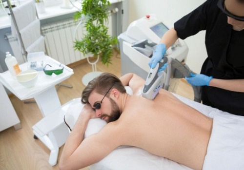 depilaci�n ideal para los hombres